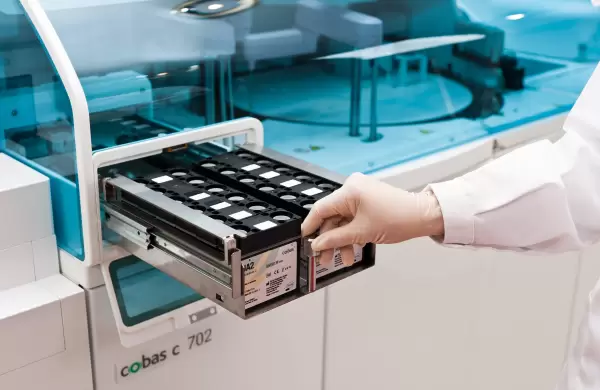 Roche alista US$ 6 millones de inversión en Ecuador