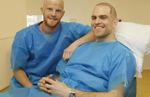 Qu es el "turismo de calvicie" y por qu Europa vive un boom del fenmeno