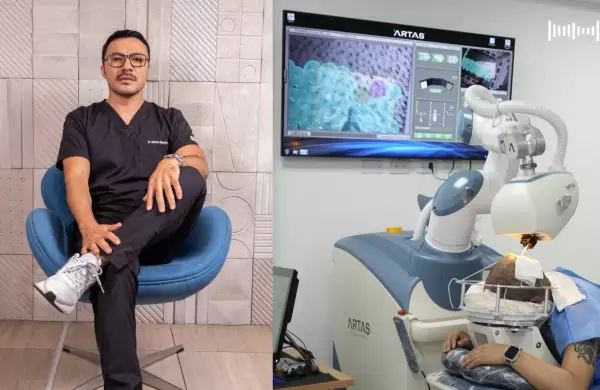 Alopecia a los 17? Conoce cmo el robot Artas iX cambia la vida de los jvenes