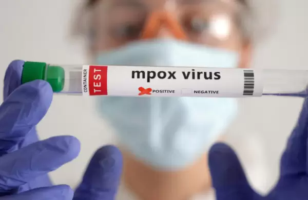 Cuál es el vínculo oculto que conecta Mpox, COVID-19 y VIH/SIDA y que es importante tomar conciencia ante los nuevos casos epidemiológicos