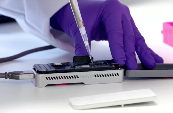 ¿Cómo funciona? Así es el sistema creado para detectar un riesgo de pandemia